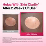 Anua Niacinamide 10% + TXA 4% Dark Spot Correcting Serum (30ml) - Image 3