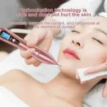 Freckles Removal Device - Image 7